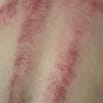 THỦY LAM Chăm Sóc Phục Hồi Sức Khỏe ĐÔNG Y Tuyển KTV Massage Body Foot