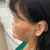 Những rủi ro khi mua máy trợ thính không chính hãng  