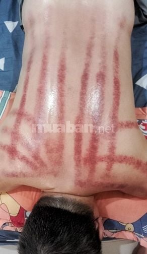 🎯 MASSAGE KHỎE TẬN NƠI 🎯TRONG SÀI GÒN💪