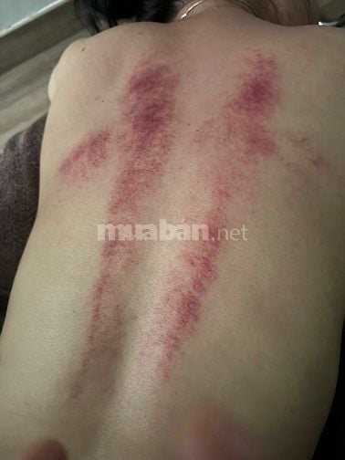 THỦY LAM Massage Điều Trị Chăm Sóc Sức Khỏe ĐÔNG Y Nam & Nữ Tại Nhà 