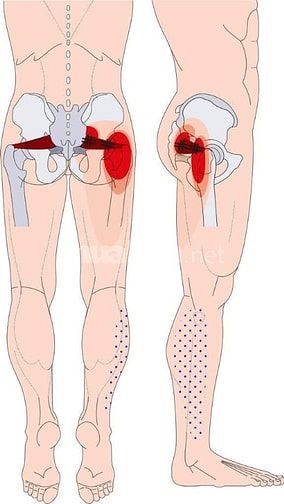 Massage- Huyệt trị liệu các rối loạn tâm sinh lý, thần kinh..