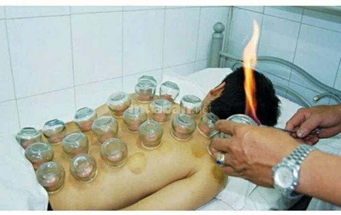 DỊCH VỤ CẠO GIÓ GIÁC HƠI TẠI NHÀ 