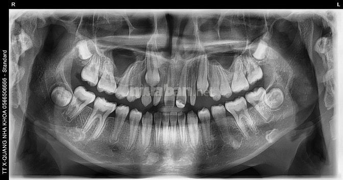 Tuyển phụ tá, điều dưỡng nha khoa