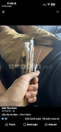 Lấy ráy tai tận nhà hoặc khách sạn dành cho Nam giá rẻ 50k