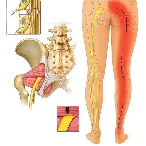 Massage- Huyệt hỗ trợ trị liệu các rối loạn tâm sinh lý, thần kinh..
