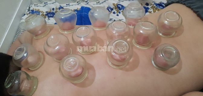 Cạo Gió Giác Hơi Xoa Bóp vai gáy cổ chân body đả thông kịn lạc