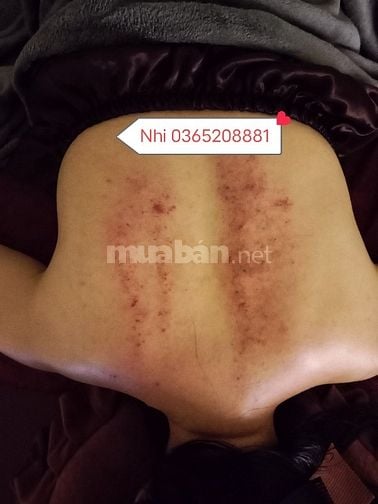 👌MASSAGE XUYÊN TẾT 2025😍ẤN HUYỆT😊ĐÁ NÓNG😍GIÁC HƠI LỬA😁