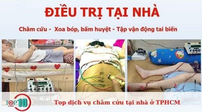 Châm cứu tại nhà bởi BS ĐH Y Dược làm , chuyên môn cao. Giá: 200k/45p 