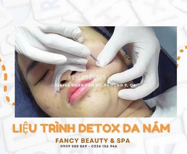 FANCY BEAUTY & SPA Q4 tuyển KTV SPA ưu tiên có KN lấy mụn 