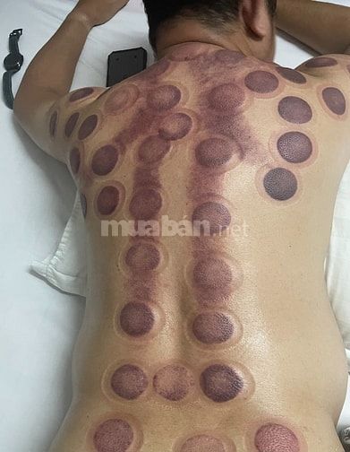 MASSAGE KHỎE THUẦN TÚY, MASSAGE ĐÁ NÓNG, GIÁC HƠI, XÔNG HƠI TẬN NHÀ