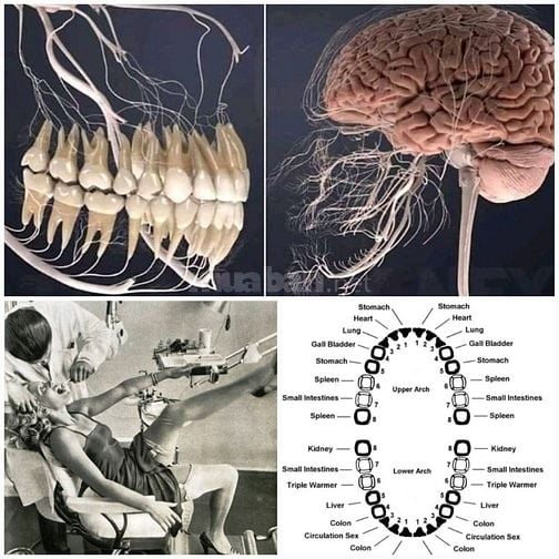 THUỐC CHỮA ĐAU RĂNG HOÀNG LIÊN THẢO DƯỢC. CÓ THỂ GIẢM ĐAU SAU 5 PHÚT