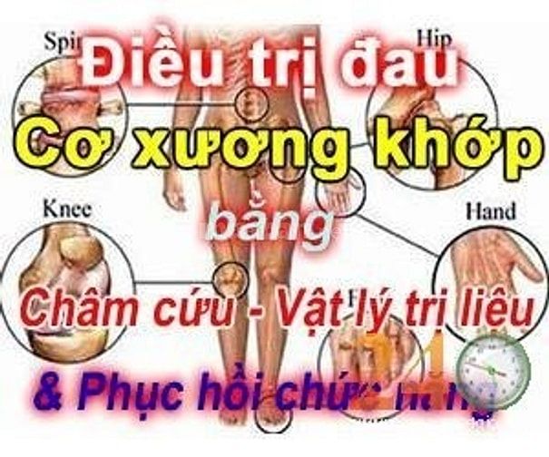 Bác sĩ châm cứu, tập vật lý trị liệu chữa liệt, cơ xương khớp tận nhà 