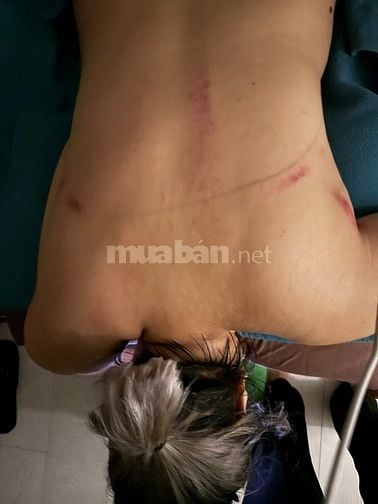 Bấm huyệt massage chăm sóc phục hồi sức khỏe đông y tại nhà 