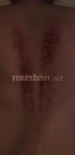 Bấm huyệt massage chăm sóc phục hồi sức khỏe đông y tại nhà 