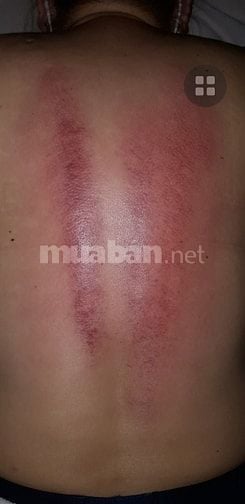THỦY LAM massage điều trị phục hồi sức khỏe ĐÔNG Y NAM NỮ tại nhà 