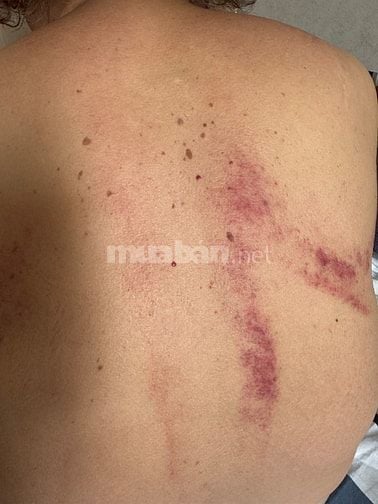 THỦY LAM Massage Điều Trị Chăm Sóc Sức Khỏe ĐÔNG Y Nam & Nữ Tại Nhà 