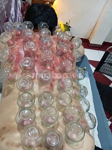Cạo Gió - Giác Hơi - Cắt Lễ - Xoa Bóp - Xông Hơi (tại nhà)