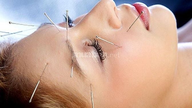 CHĂM SÓC SỨC KHỎE TẠI NHÀ BẰNG CHÂM CỨU – BẤM HUYỆT ĐÔNG Y