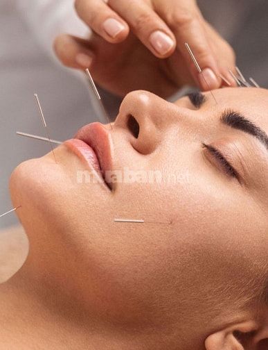 CHĂM SÓC SỨC KHỎE TẠI NHÀ BẰNG CHÂM CỨU – BẤM HUYỆT ĐÔNG Y