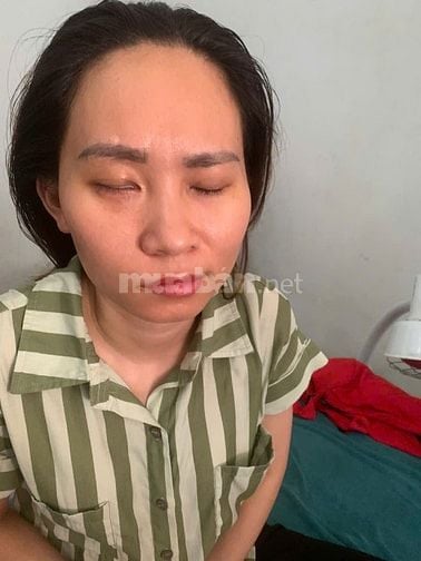 CHĂM SÓC SỨC KHỎE TẠI NHÀ BẰNG CHÂM CỨU – BẤM HUYỆT ĐÔNG Y