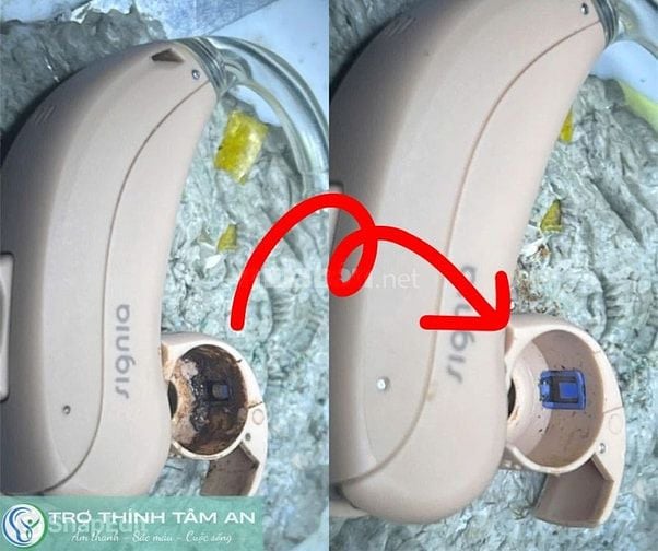[MIỄN PHÍ] Bảo dường máy trợ thính định kỳ tại Tâm An Nam Định