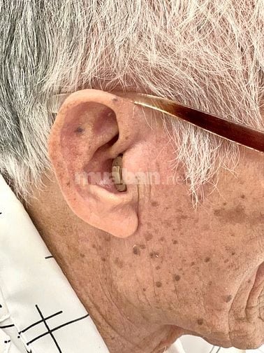 Máy trợ thính Prompt CIC – nhỏ gọn trong tai, mạnh mẽ trong từng âm th