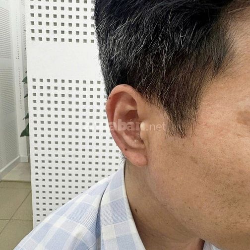 10 năm chịu đựng nghe kém để đi tìm một giải pháp đủ nhỏ gọn, đủ thẩm 