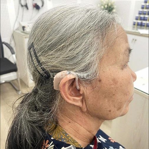 Nghe kém hơn  vì đeo máy trợ thính kém chất lượng