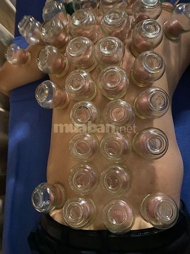 Cạo Gió -Giác Hơi - Xoa Bóp (Tận Nhà)