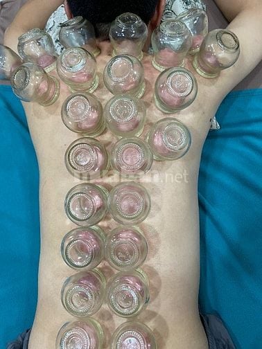 Cạo Gió -Giác Hơi - Xoa Bóp (Tận Nhà)