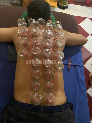 Cạo Gió - Giác Hơi - Chăm Sóc Sức Khoẻ (Tại Nhà)