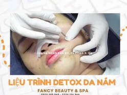 FANCY BEAUTY & SPA Q4 tuyển KTV SPA ưu tiên có KN lấy mụn 