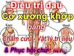 Bác sĩ châm cứu, tập vật lý trị liệu chữa liệt, cơ xương khớp tận nhà 