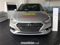 Hyundai Accent Base Có Sẵn, hãy liên hệ nhanh nếu bạn cần Hyundai Accent Base Có Sẵn, hãy liên hệ nhanh nếu bạn cần