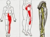Nhận dịch vụ chăm sóc sức khoẻ, vật lý trị liệu toàn thân tận nơi Nhận dịch vụ chăm sóc sức khoẻ, vật lý trị liệu toàn thân tận nơi