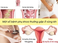 Gel PLSUR chăm sóc vùng kín phụ nữ Gel PLSUR chăm sóc vùng kín phụ nữ