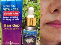 Tinh C12 serum nám da nhat bản Tinh C12 serum nám da nhat bản