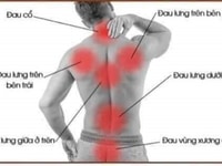 Chăm sóc sức khỏe cột sống lưng và đau nhức mỏi toàn thân Chăm sóc sức khỏe cột sống lưng và đau nhức mỏi toàn thân