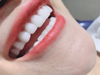 Nha khoa Thẩm Mỹ Quốc Tế (Răng Hàm Mặt) Nha khoa Thẩm Mỹ Quốc Tế (Răng Hàm Mặt)