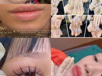 Dịch vụ TIÊM FILLER - NAIL MI - SPA Chuyên nghiệp - Uy tín tại Sài Gòn Dịch vụ TIÊM FILLER - NAIL MI - SPA Chuyên nghiệp - Uy tín tại Sài Gòn