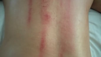  MASSAGE XUYÊN TỈNH WAX LÔNG GIÁC HƠI ĐÁ NÓNG