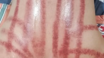 MASSAGE 2026 ẤN HUYỆT WAX LÔNG ĐÁ NÓNG GIÁC HƠI LỬA