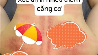 Combo giải cảm - Đầu cổ vai gáy - cột sống thắt lưng eo - Sàn chậu .