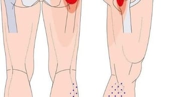 Massage- Huyệt trị liệu các rối loạn tâm sinh lý, thần kinh..