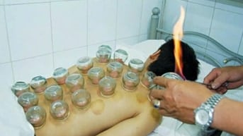 DỊCH VỤ CẠO GIÓ GIÁC HƠI TẠI NHÀ 