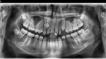 Tuyển phụ tá, điều dưỡng nha khoa