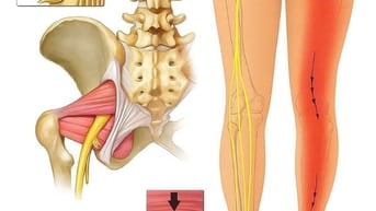 Massage- Huyệt hỗ trợ trị liệu các rối loạn tâm sinh lý, thần kinh..